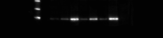 Western Blot